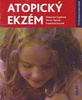 Atopický ekzém - Štěpánka Čapková; Václav Špičák; František Vosmík