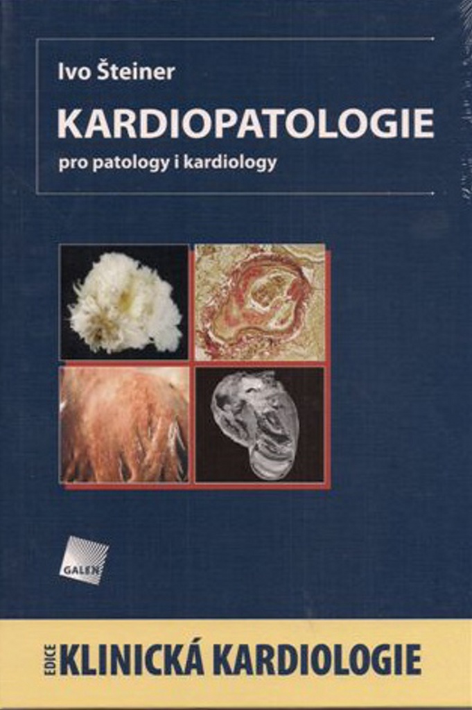 Kardiopatologie - Ivo Šteiner