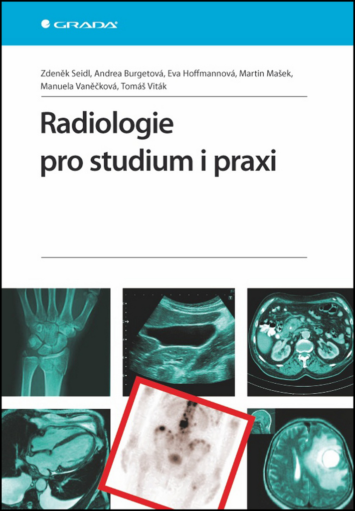 Radiologie pro studium i praxi - Zdeněk Seidl