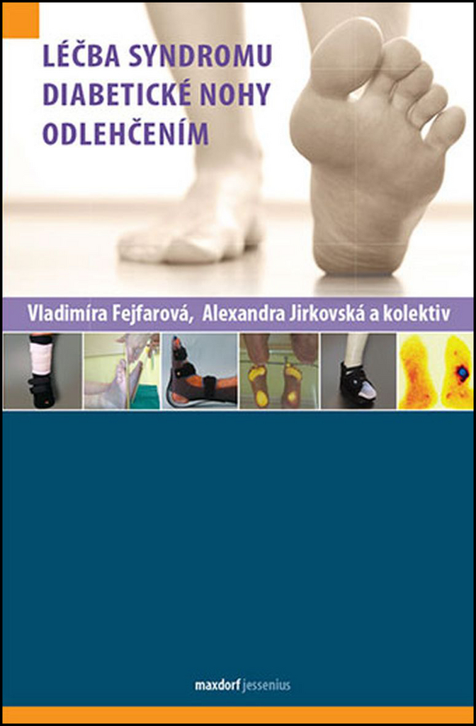 Léčba syndromu diabetické nohy odlehčením - Alexandra Jirkovská