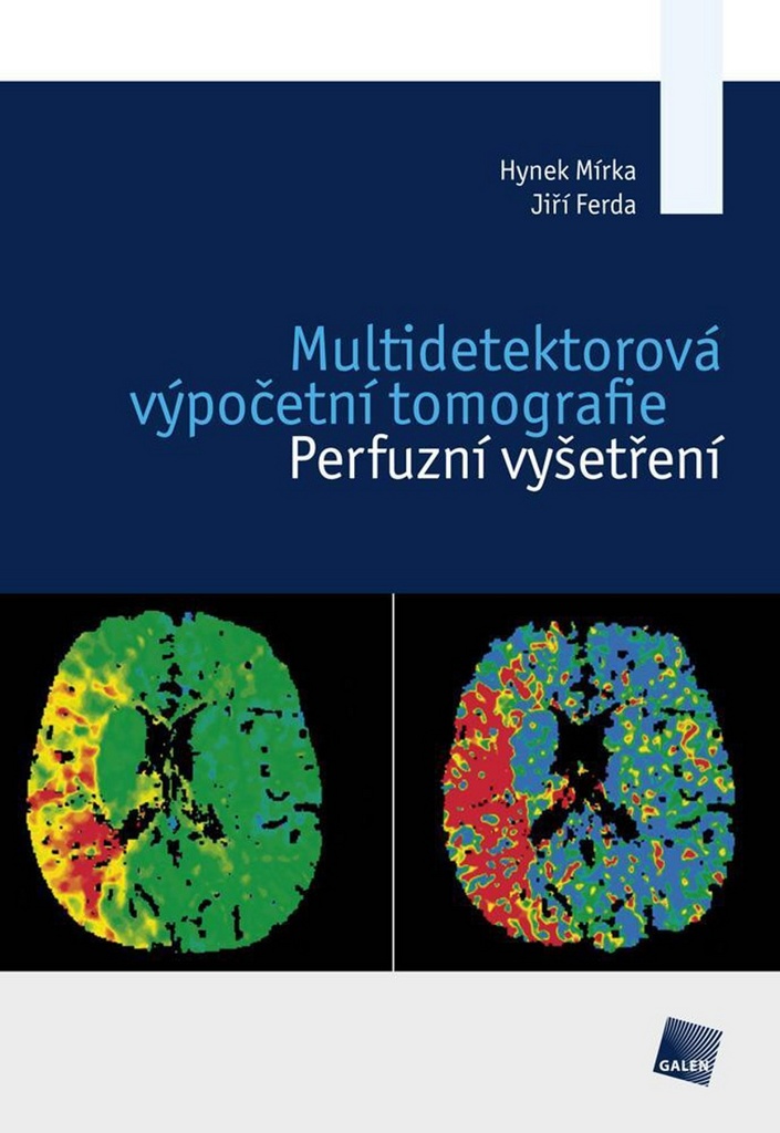 Multidetektorová výpočetní tomografie - Jiří Ferda