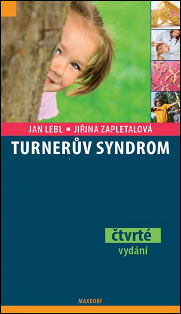 Turnerův syndrom - Jan Lebl