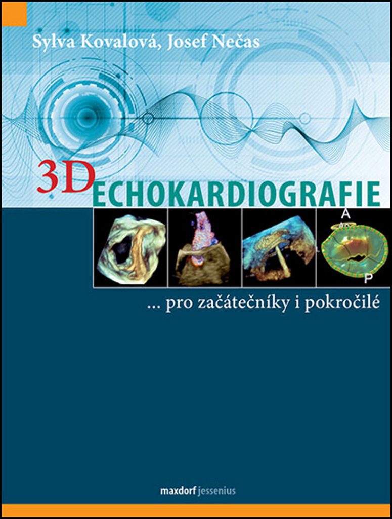 3D Echokardiografie - Sylva Kovalová