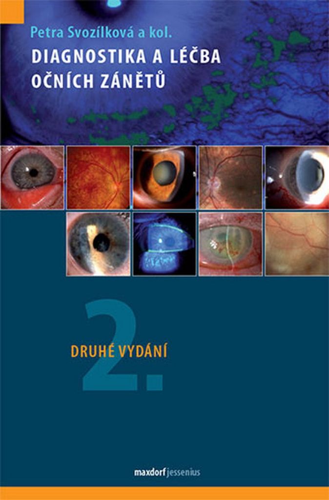 Diagnostika a léčba očních zánětů - Petra Svozílková