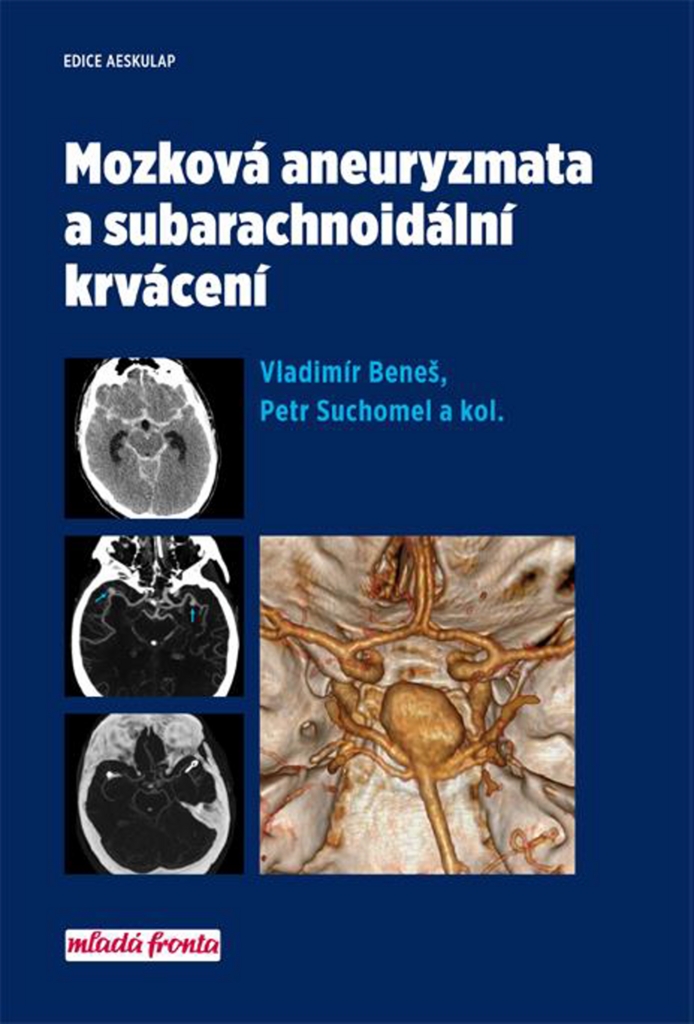 Mozková aneurysmata a subarachnoidální krvácení - Vladimír Beneš