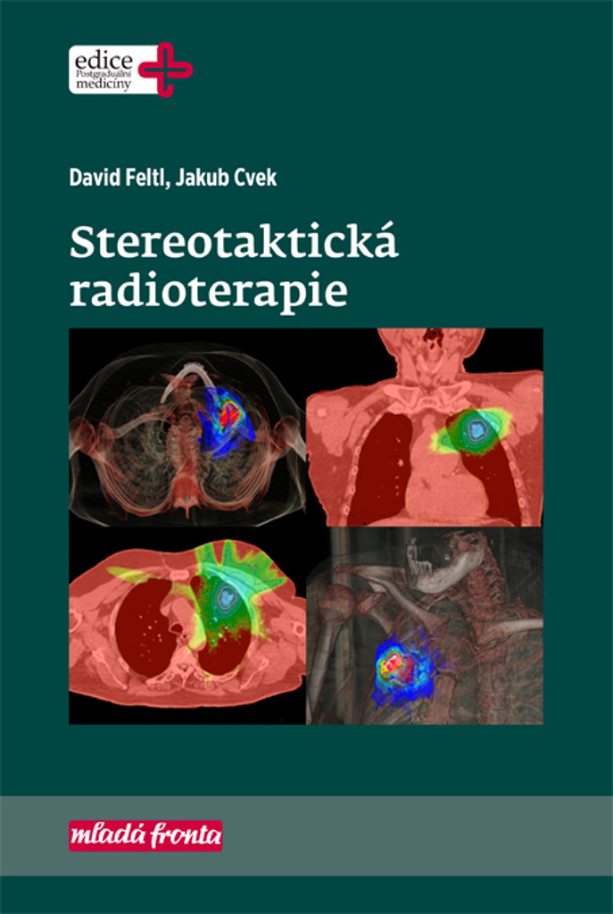 Stereotaktická radioterapie - David Feltl