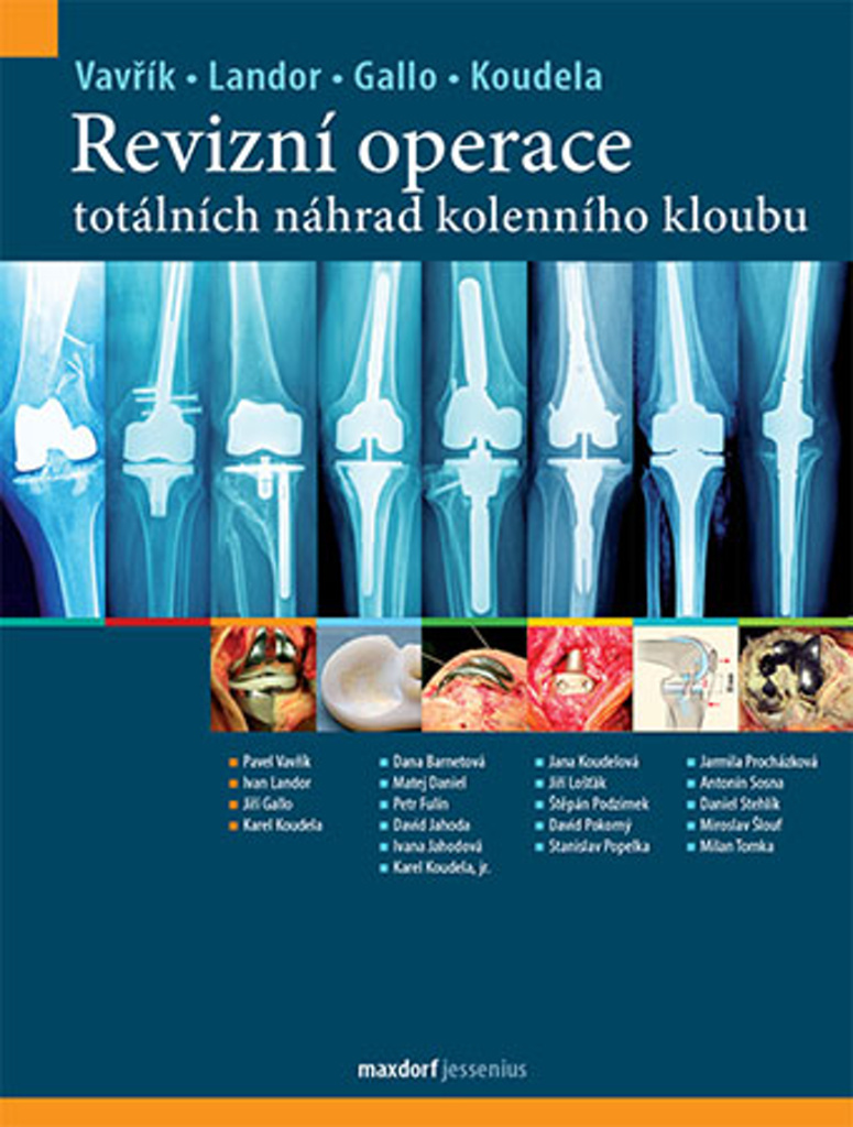 Revizní operace totálních náhrad kolenního kloubu - Ivan Landor