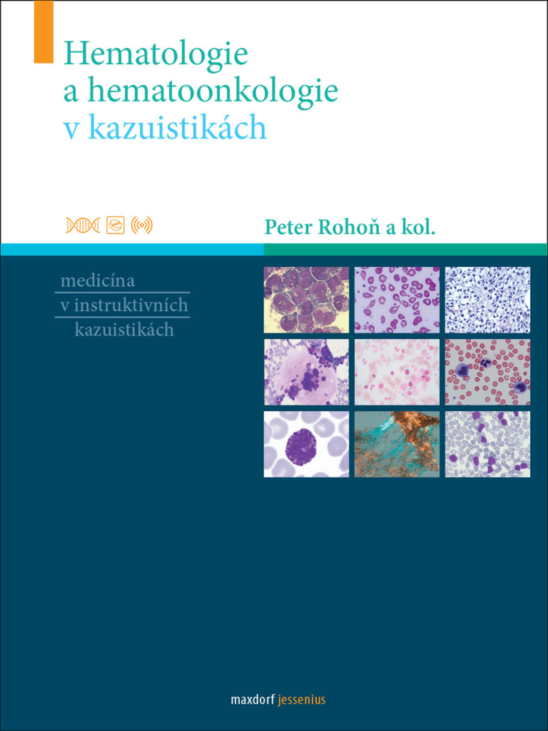 Hematologie a hematoonkologie v kazuistikách - Peter Rohoň