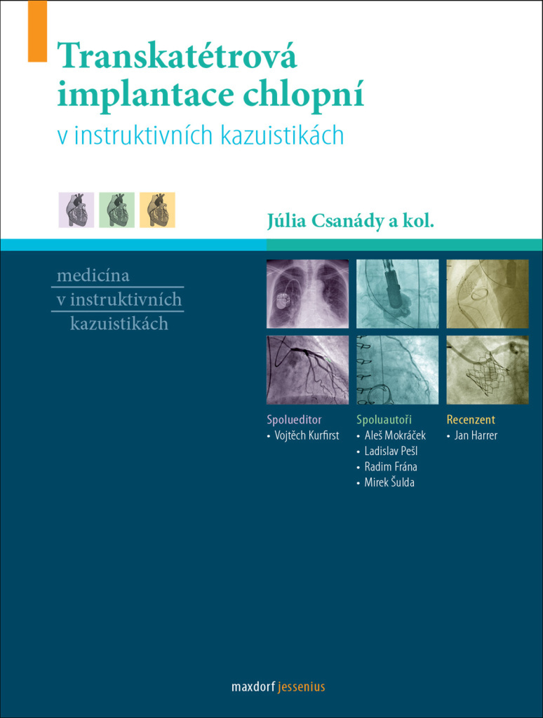 Transkatétrová implantace chlopní v instruktivních kazuistikách - Júlia Csanády