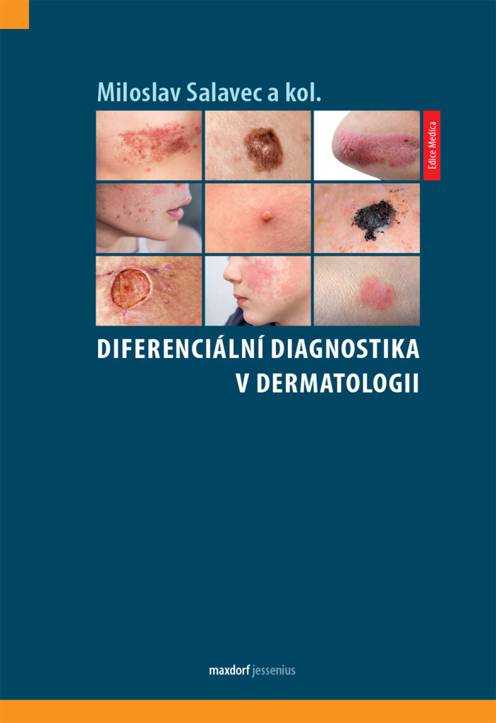 Diferenciální diagnostika v dermatologii - Miloslav Salavec